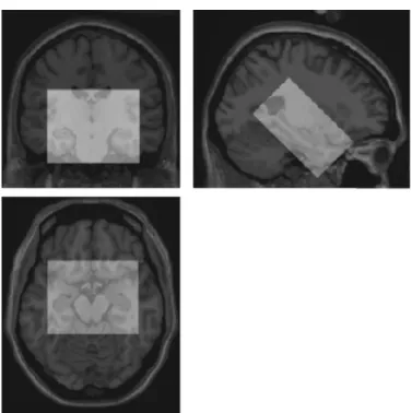 Fig. 1. Coronal, sagittal, and transverse views through the Colin27 high-reso- high-reso-lution target with the 405 000 voxel VOI (superimposed in white), centered on the medial temporal lobe.