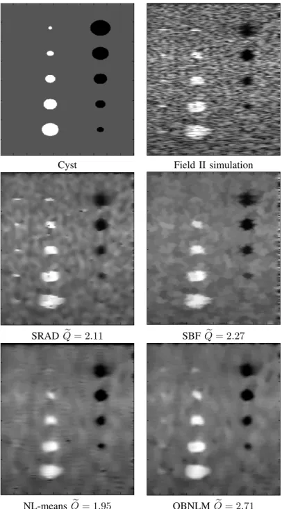 Fig. 4. Denoised images obtained with the compared filters for the Field II experiment and the corresponding Q ˜ indexes.