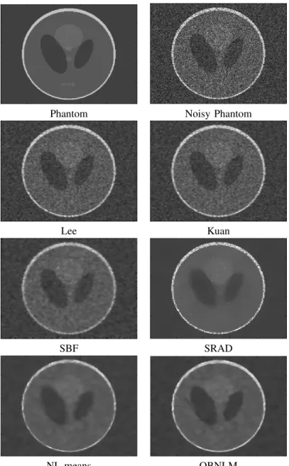 Fig. 3. Results obtained with different filters applied to the “Phantom” image corrupted with signal-dependent noise (σ = 0.4)