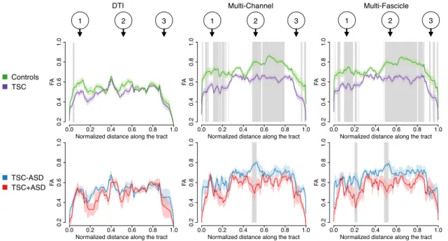 Figure 12: Fascicle-based spatial statistics of multi-fascicle models reveal local diﬀerences in the white fascicle properties that single tensor DTI cannot