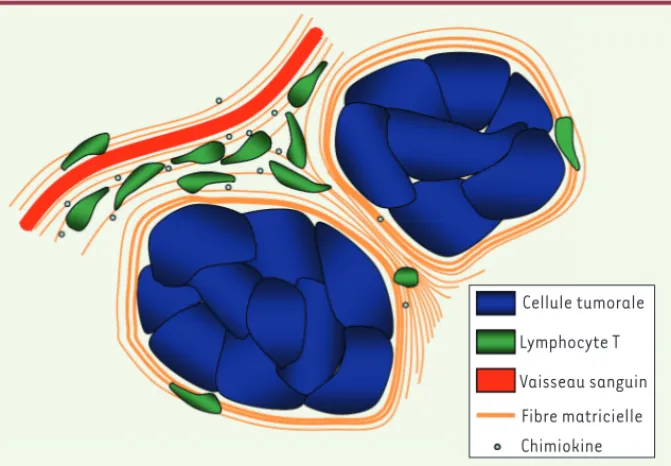 Figure 2.  Dans les tumeurs pulmonaires humaines, les lymphocytes T ont un accès limité aux  régions tumorales