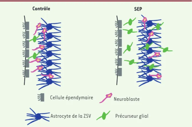 Figure 2. La ZSV change également chez les patients atteints de SEP. Une des différences majeures entre  l’architecture de la ZSV humaine et celle de souris est la présence de régions cellulaires bien définies