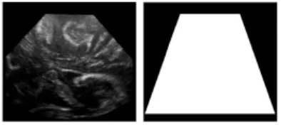 Fig. 2 Ultrasound image and corresponding mask. To reduce the computation time, only points belonging to the mask are denoised.