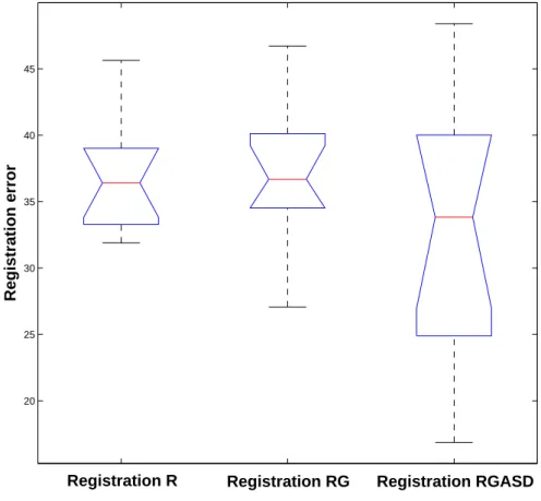 Fig. 11. Box plot of the registration errors computed with the Frobenius matrix norm. From left to right : standard Registration (R), Registration working only on the B-scan Geometry mask (RG) and Registration that accounts for B-scan Geometry and Acoustic