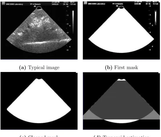 Fig. 1. Illustration of the automatic mask extraction. (a) shows a typical image of the acquired sequence