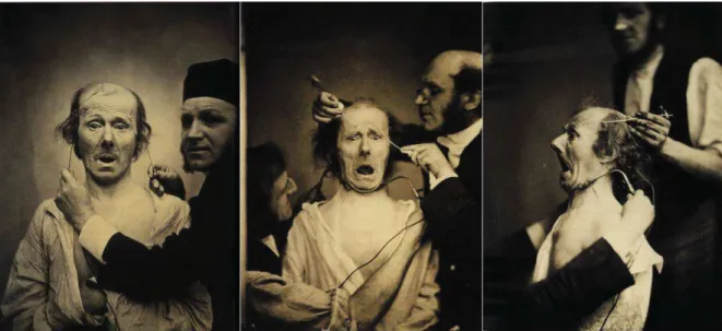 Figure  2.  Duchenne  de  Boulogne,  réalisant  des  expériences  sur  différentes  expressions  faciales déclenchées par des stimulations électriques