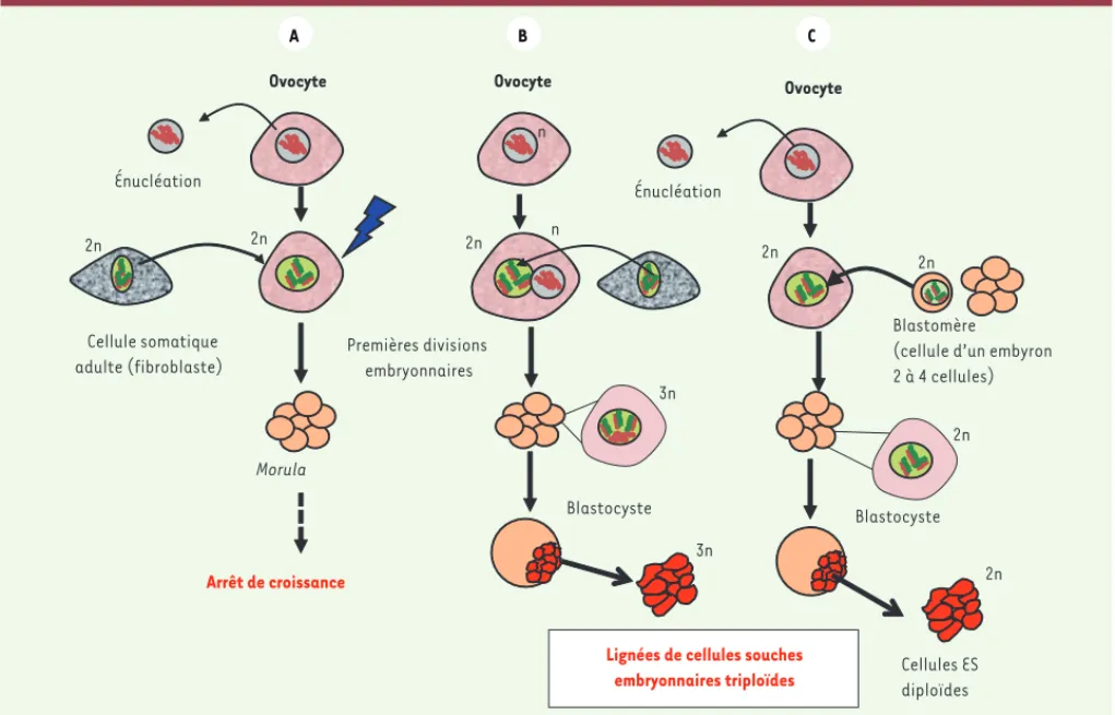 Figure 1. Schéma du protocole expérimental de transfert nucléaire dans des ovocytes humains