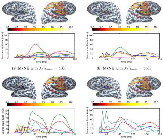 Fig. 8: Source reconstruction results using SEFs evoked by electrical stimulation of the left median nerve