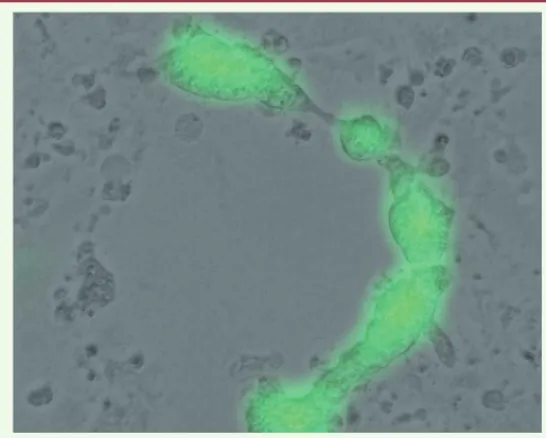 Figure 3. Modification de la spécificité de liaison du virus de la rougeole. Les récepteurs  connus du virus de la rougeole sont la protéine CD150 ou SLAM (exprimée à la surface de  lym-phocytes B et T), la protéine CD46 (exprimée à la surface des cellules