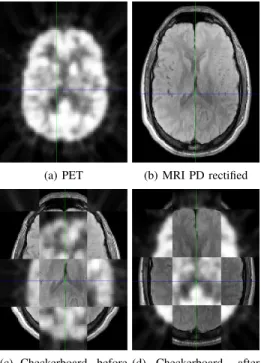 Fig. 3. PET/MRI RIRE database registration example. (a) Original PET volume. (b) Original PD rectified MRI