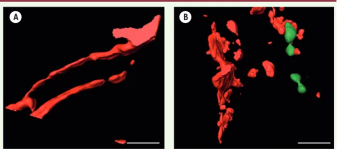 Figure 1. Analyse de l’intégrité vasculaire cardiaque après ischémie-reperfusion. Reconstruction  en trois dimensions d’images de microscopie confocale sur cryocoupes de cœur après révélation  de la VE-cadhérine (rouge) par immunomarquage