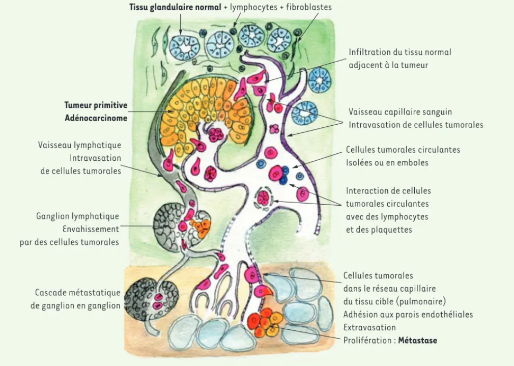 Figure 1. Les différentes étapes du processus métastatique. La métastase de cellules tumorales à partir de la tumeur primitive est possible, soit  directement par voie hématogène, soit après invasion du tissu normal voisin, par voie lymphatique