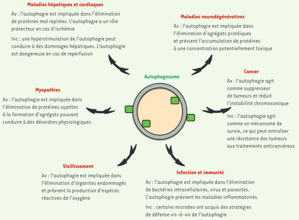 Figure 1. Implication de processus d’autophagie au cours des pathologies humaines. Av : avantages ; Inc : inconvénients.
