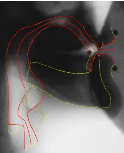 Figure 2: Centerline obtained an X-ray image of a sound /i/.
