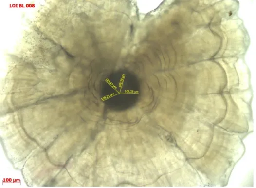 Figure 10 : Nucleus d’asteriscus de silure en plan sagittal observé en lumière transmise sous  microscope, grossissement 10X / 0,25 © L