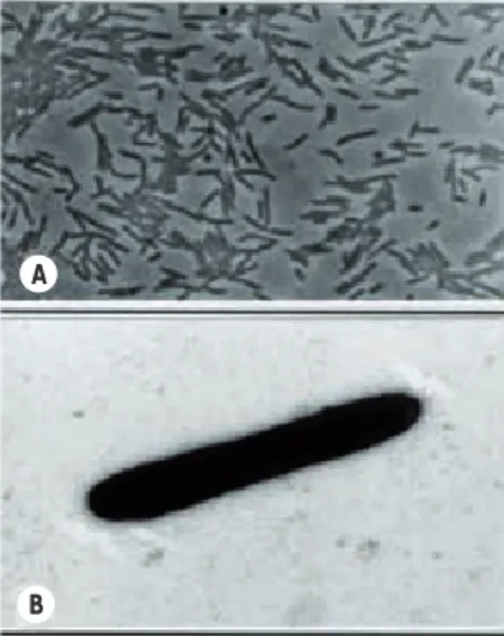 Figure 5. Zobellia galactanivorans. A. Colonies  en contraste de phase. B.  En microscopie   électronique (pas de flagelle visible) [2].