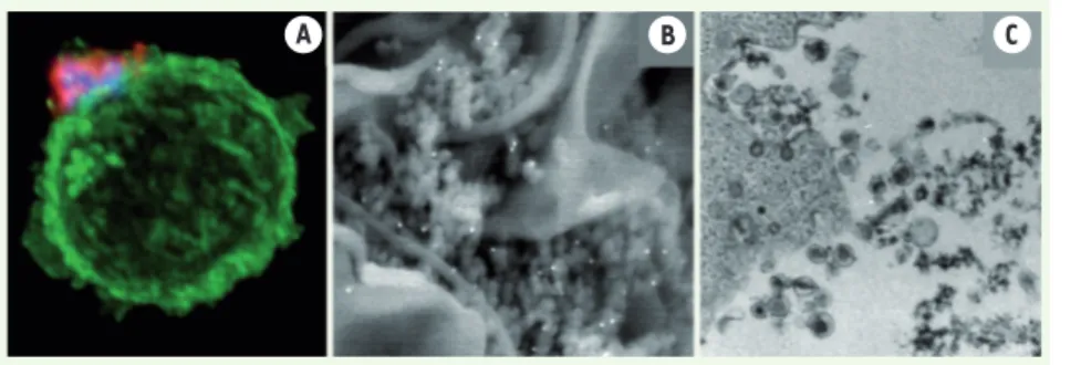 Figure 2.  Lymphocyte T infecté par HTLV-1 pré- pré-sentant à sa surface un « biofilm viral »