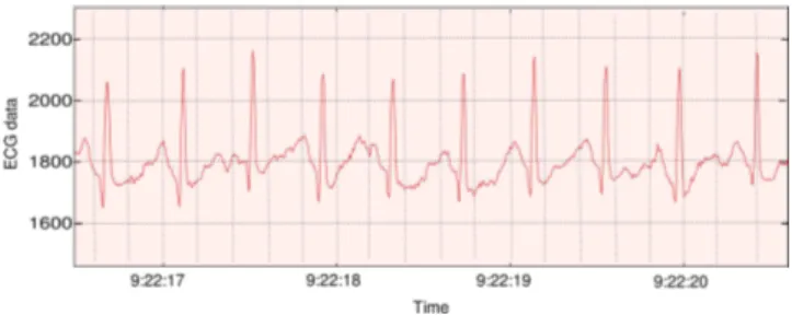 Figure 6: Example of ECG data collected from a runner’s sensor during the race