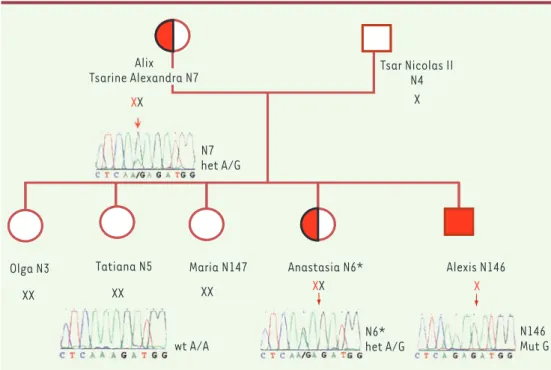 Figure 2.  Transmission de  la mutation dans l’intron 3  (IV S3-3A → G) du gène F9  dans la famille Romanov.