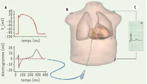 Figure 5.  Insertion du cœur dans un modèle  de torse A. Potentiel membranaire (haut) et  électrogramme (bas) mesurable par un  cathé-ter endocardique