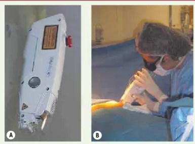 Tableau I. Quantification du collagène de type I et type III dans des plaies trai- trai-tées par laser diode 810 nm ou des plaies contrôles