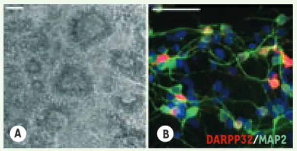 Figure 1.  Différenciation des cellules souches embryonnaires  humaines en neurones striataux