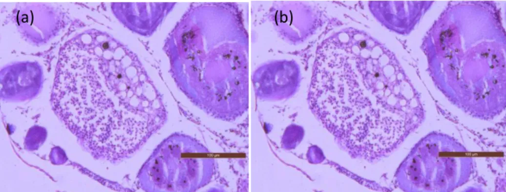 Figure  44.  Microphotographies  de  coupes  histologiques  d’un  ovaire  montrant  l’ovocyte  en  phase (a) alpha-atrésie avancée et (b) bêta-atrésie