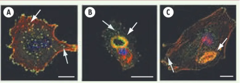 Figure 2. L’agencement des podosomes varie selon l’inducteur  et le type de cellule endothéliale