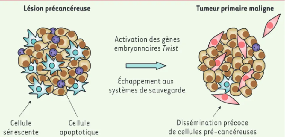 Figure 1. Modèle alternatif de progression tumorale.