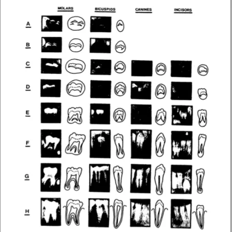 Figure 2 : Stades de développement de la dentition permanente selon Demirjian.
