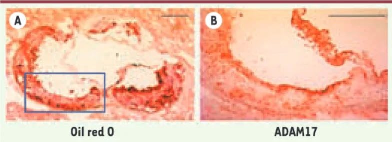 Figure 4.  Expression d’ADAM17 dans les lésions d’athérosclé- rose chez la souris. Microphotographie de lésions  d’athérosclé-rose du sinus aortique de souris apoE -/-  après 15 semaines de  régime gras [28, 29]