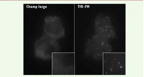 Figure 1.  Visualisation des particules virales à la membrane plasmique avec la technique du  TIR-FM