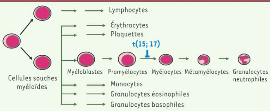 Figure 1. Caractéristiques de la leucémie aiguë  promyélocytaire.  La LAP est caractérisée par  la translocation chromosomique t(15 ; 17) qui  fusionne les gènes PML et RARα aboutissant à  la synthèse de l’oncoprotéine PML-RARα qui  bloque les cellules au 