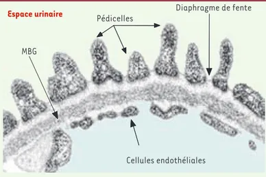 Figure 1. La barrière de filtration glomérulaire en microscopie  électronique. MBG : membrane basale glomérulaire.