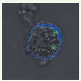 Figure 1.  Morphologie en microscopie confocale d’une cellule  IKDC (CD11c + - AlexaFluor 647, Bleu) activée par  IL-15/IL-15Ra et ayant phagocyté des cellules de la lignée tumorale  mourante B16F10 (CMFDA, Vert).