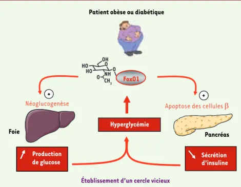 Figure 2. Implication potentielle de FoxO1 dans le phénomène de glucotoxicité.