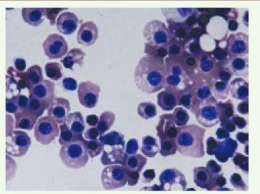 Figure 2. Morphologie des érythrocytes dérivés des cellules souches embryonnai- embryonnai-res humaines (ESh) après différenciation terminale dans la voie érythrocytaire