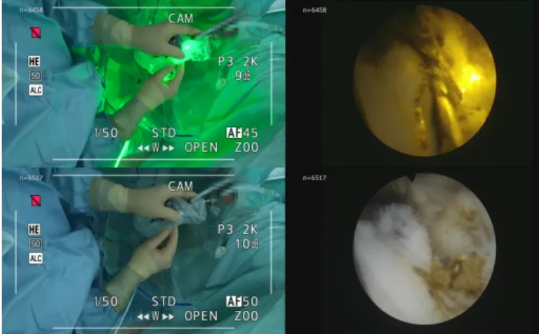 Fig. 6. Synchronized real-time videos using DICOM-RTV captured from the operating room during a surgery