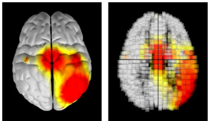 Figure 3: Brain visualization techniques. Left: topography display of surface brain activity