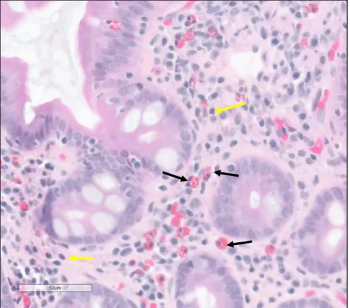 Figure 10.! Identification d'un lymphocyte et d'un éosinophile à l'HEPS. 