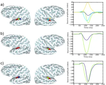 Fig. 3: Source reconstruction using AEF data evoked by left auditory stimulation: (a) TF-MxNE with λ/λ max = 55%, (b) TF-MxNE with λ/λ max = 70%, and (c) irTF-MxNE with λ/λ max = 55%