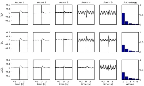 Figure 4: Dictionaries learned on LFP epochs using PCA, DL, and JADL.