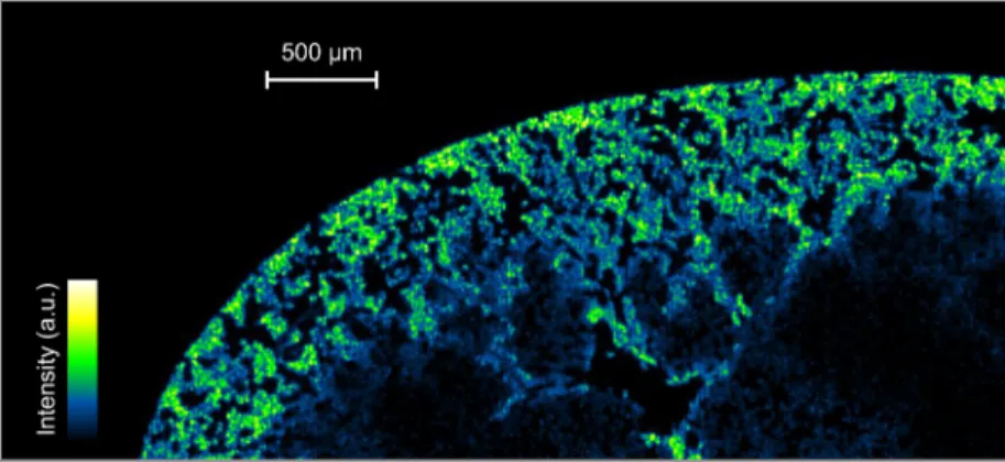 Figure 3. High-de ﬁ nition image of Gd obtained by LIBS. The kidney was screened with a spatial resolution of 10 μ m (80 000 pixels), currently the highest resolution that might be obtained using LIBS