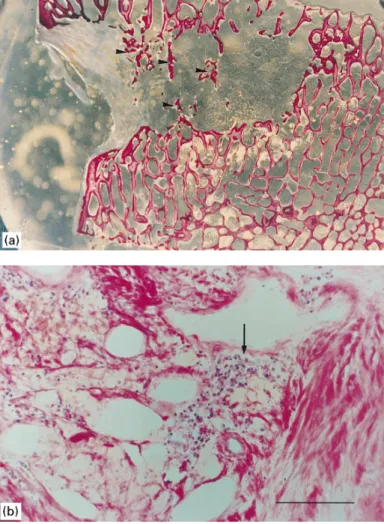 Fig. 4. (a) Photograph of a four-month-implanted control sample showing an implant osteolysis leaving some fragments of degraded trabeculae in a connective tissue which had invaded the site ( )