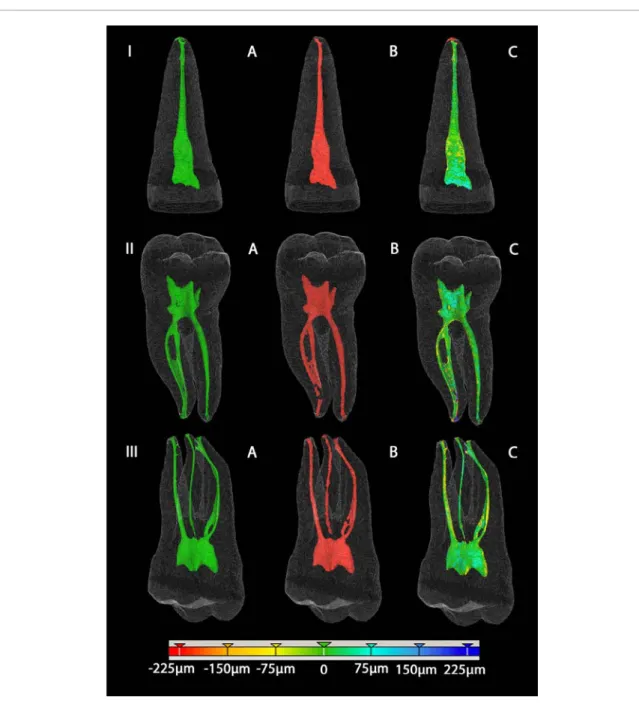 Figure 6.  3D visualizations of the segmentations with the incisive (I) at the top, the lower molar (II) in the middle and the upper  molar (III) below
