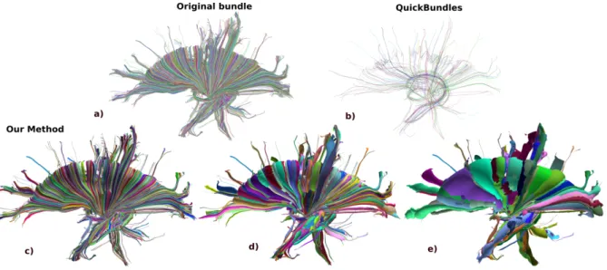 Figure 3: a) Thalamocortical bundle with 19,782 fibers, b) reduced to 275 prototypes with QuickBundles (Threshold=7mm), c), d) and e) reduced to 6925, 1422 and 275 cylinders with our method.