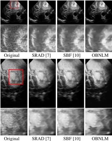 Fig. 3. Denoised images obtained by the compared filters and the corresponding Q˜ index