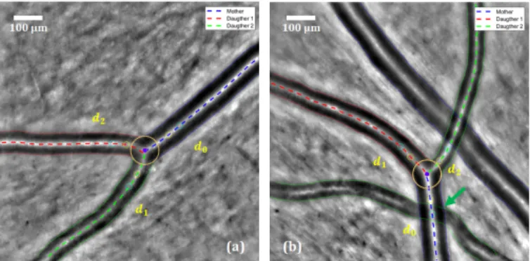 Fig. 6: Final segmentation of an arterial bifurcation on two examples. The green arrow indicates the improvement with respect to the result in Figure 4.