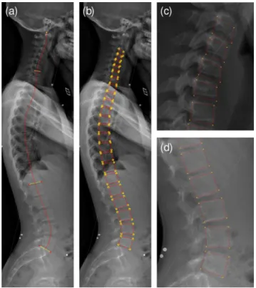 Figure 2 (a) Sacrum endplate, T12 inferior and C7 superior endplates along with odontoid are first manually annotated, from which  the 2D approximate spine shape model in (b) is computed