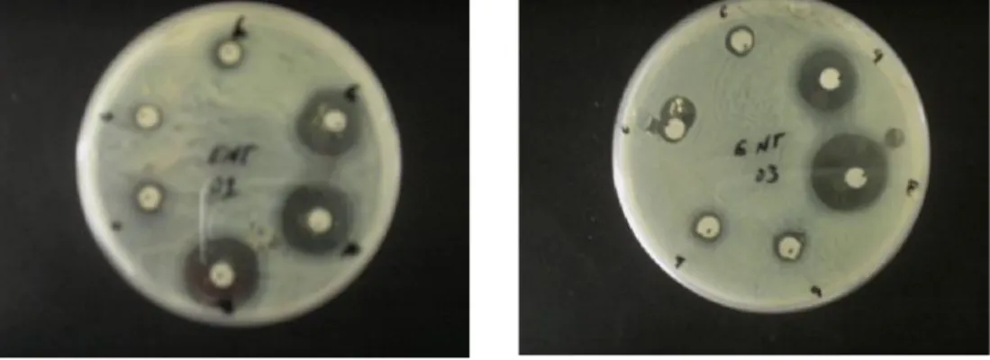 Table 2. Sensitivity of the bacteria